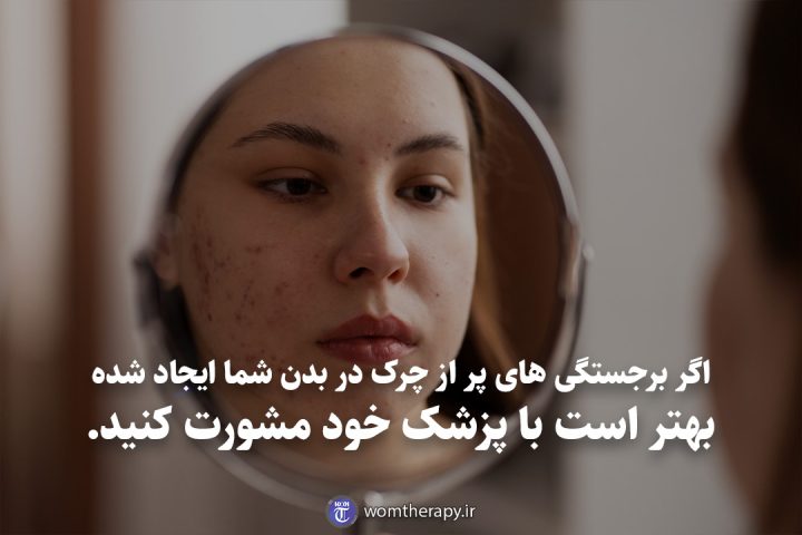 اگر برجستگی های پر از چرک در بدن شما ایجاد شده بهتر است با پزشک خود مشورت کنید.
