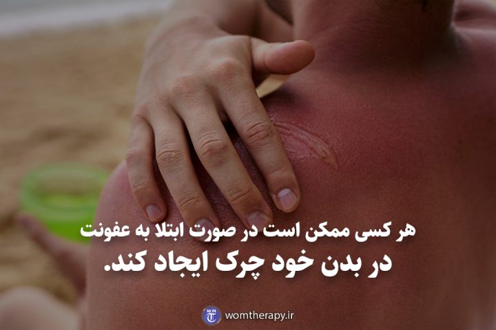 هر کسی ممکن است در صورت ابتلا به عفونت در بدن خود چرک ایجاد کند.
