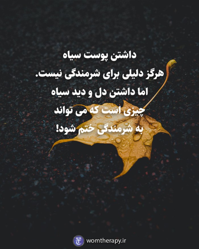 داشتن پوست سیاه هرگز دلیلی برای شرمندگی نیست. اما داشتن دل و دید سیاه چیزی است که می تواند به شرمندگی ختم شود!